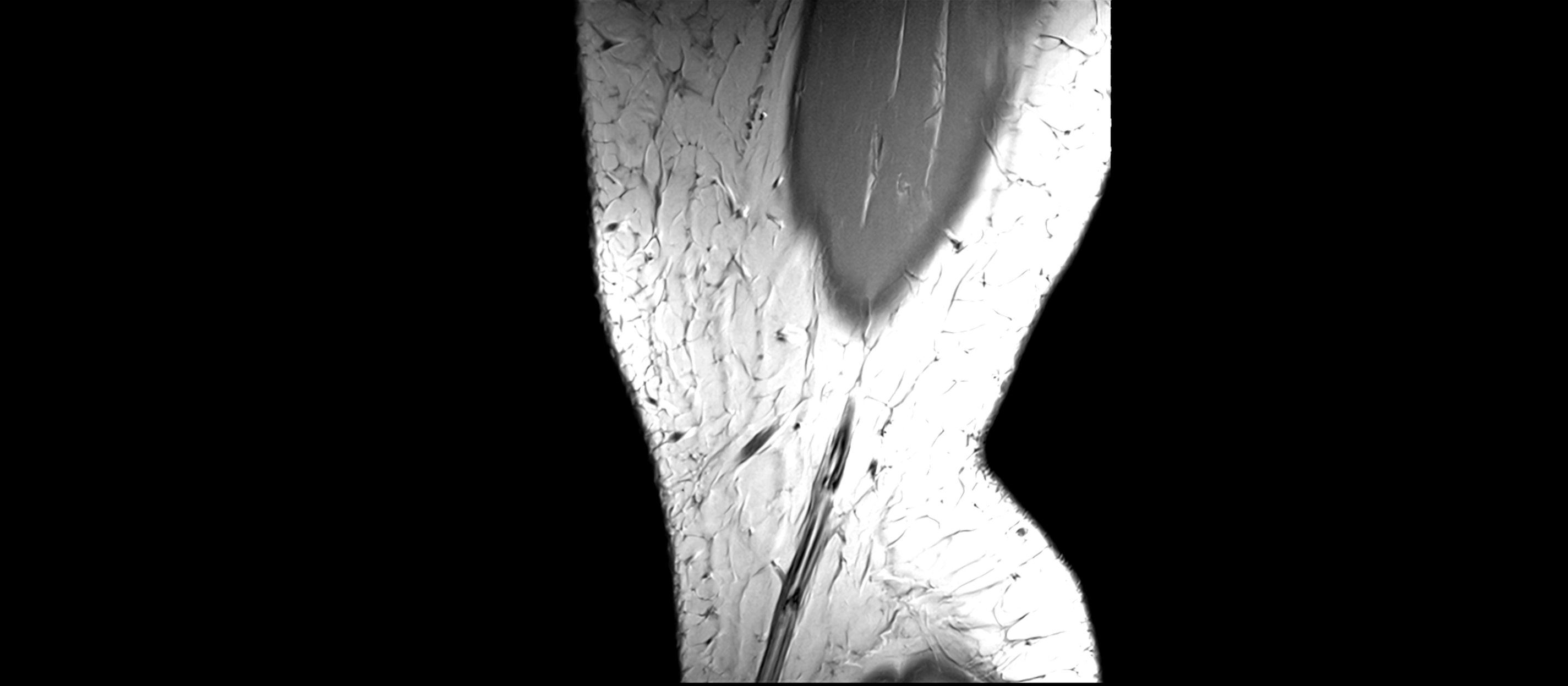MRI sagittal  ligaments cross sectional anatomy 3T  radiology  image-img-00001-00001.webp